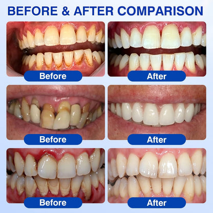 𝐇𝐈𝐒𝐊𝐈𝐍®👩‍⚕️🇿🇦🏅🦷🛡️ HISKIN® GumRevive Periodontal Repair Gel