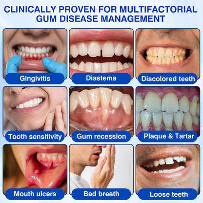 𝐇𝐈𝐒𝐊𝐈𝐍®👩‍⚕️🇿🇦🏅🦷🛡️ HISKIN® GumRevive Periodontal Repair Gel