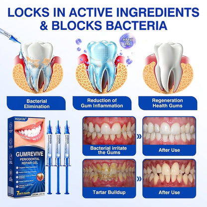 𝐇𝐈𝐒𝐊𝐈𝐍®👩‍⚕️🇿🇦🏅🦷🛡️ HISKIN® GumRevive Periodontal Repair Gel